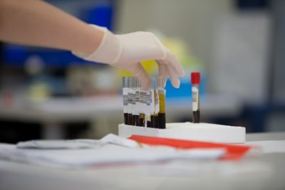De meeste testosteronkuren missen een goede test vooraf